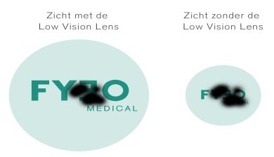 low vision lens